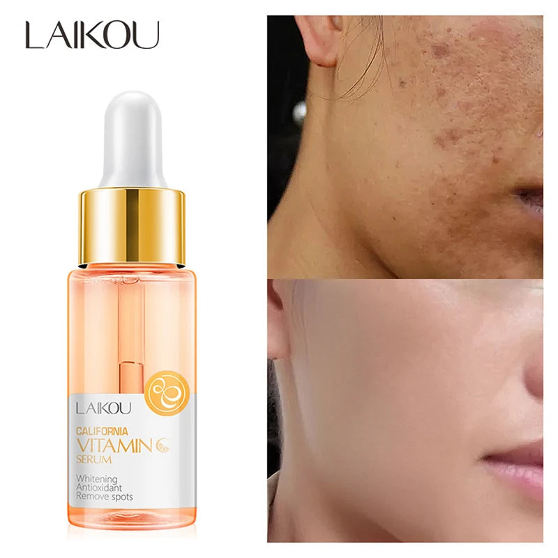 LAIKOU Vitamin C Skincare Set