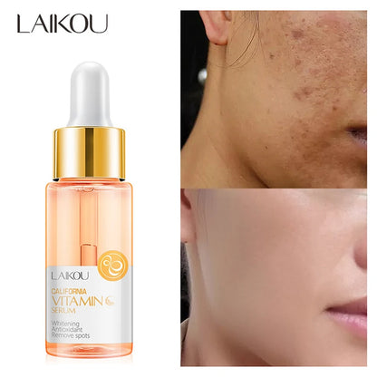 LAIKOU Vitamin C Skincare Set